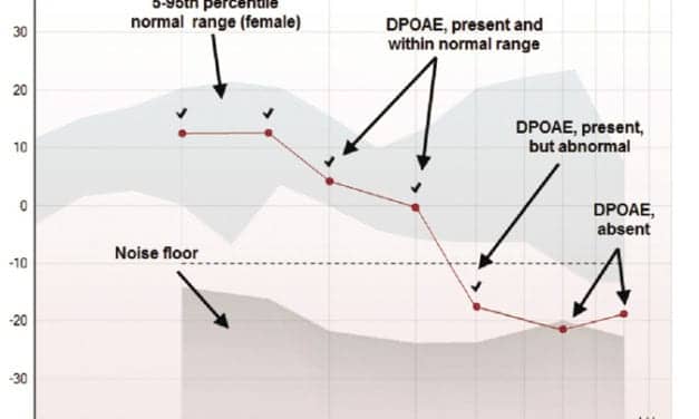 An Overview of OAEs and Normative Data for DPOAEs