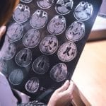 Researchers Explain Link Between Hearing Loss, Dementia