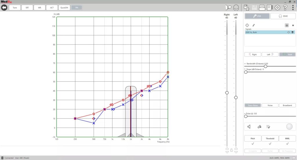 MedRx tinnitus test screenshot