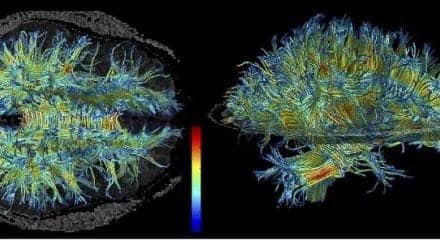 Study Finds That the Aging Brain Retains Plasticity for Learning