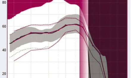 10 Questions About Frequency Compression