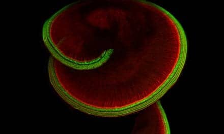 Harvard Medical School Researchers Find Sensory Protein Linked to Hearing and Balance