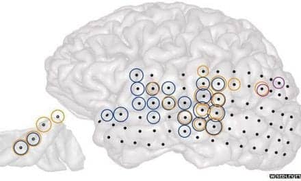 Scientists Map Tinnitus in Human Brain during Surgery