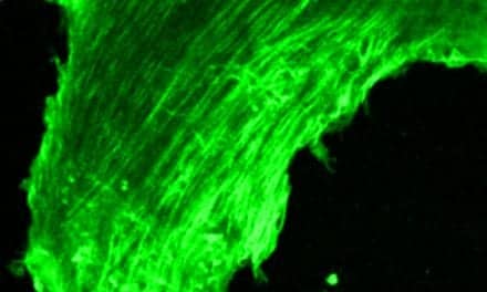 Hearing Loss Can Change How Nerve Cells Are Wired