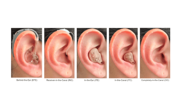 Survey Details OTC Self-Fitting Hearing Aid Users’ Experiences, Perceptions