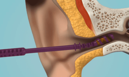 AuDNet and Earways Medical Partner on EarWay Pro Earwax Removal Product